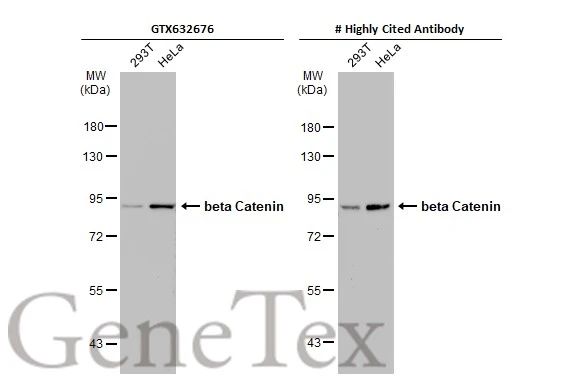 Various whole cell extracts (30 μg) were separated by 7.5% SDS-PAGE, and the membranes were blotted with beta Catenin antibody (GTX632676) diluted at 1:500 and competitor's antibody (# Highly Cited Antibody ) diluted at 1:500. The HRP-conjugated anti-mouse IgG antibody (GTX213111-01) was used to detect the primary antibody. *The competitor is not affiliated with GeneTex and does not endorse this product. Various whole cell extracts (30 μg) were separated by 7.5% SDS-PAGE, and the membranes were blotted with beta Catenin antibody (GTX632676) diluted at 1:500 and competitor's antibody (# Highly Cited Antibody ) diluted at 1:500. The HRP-conjugated anti-mouse IgG antibody (GTX213111-01) was used to detect the primary antibody. *The competitor is not affiliated with GeneTex and does not endorse this product.