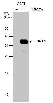 Non-transfected (–) and transfected (+) 293T whole cell extracts (30 μg) were separated by 12% SDS-PAGE, and the membrane was blotted with SGTA antibody [6A4] (GTX632697) diluted at 1:3000.