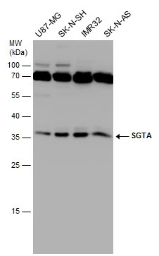 Various whole cell extracts (30 μg) were separated by 12% SDS-PAGE, and the membrane was blotted with SGTA antibody [6A4] (GTX632697) diluted at 1:500.