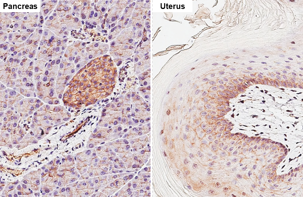 Anti-beta Catenin antibody [GT2169] (GTX633010) | GeneTex