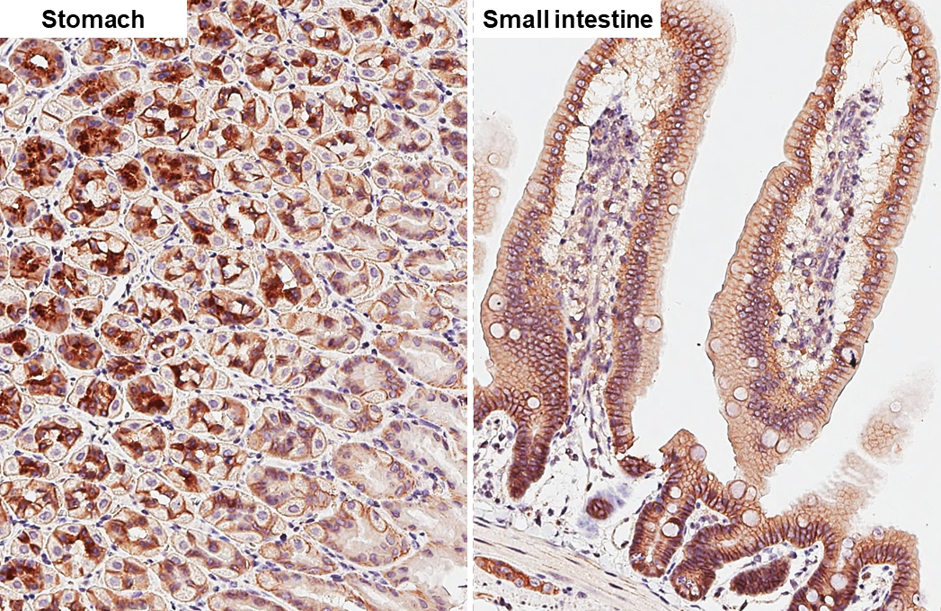 Anti-beta Catenin antibody [GT2169] (GTX633010) | GeneTex