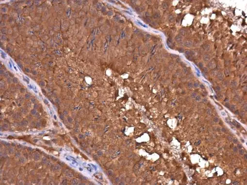 DAPP1 antibody [4H9] detects DAPP1 protein at cytoplasm in rat testis by immunohistochemical analysis. Sample: Paraffin-embedded rat testis. DAPP1 antibody [4H9] (GTX633252) diluted at 1:100. 
 Antigen Retrieval: Citrate buffer, pH 6.0, 15 min