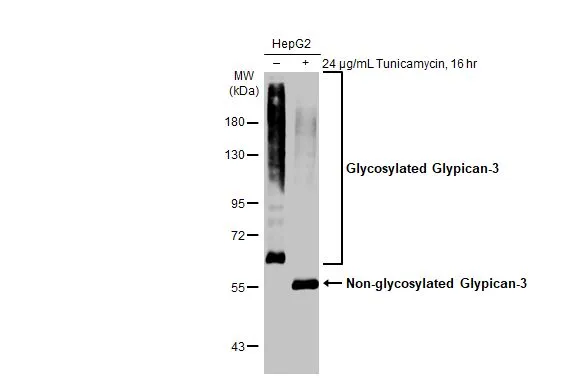 Untreated (–) and treated (+) HepG2 whole cell extracts (30 μg) were separated by 7.5% SDS-PAGE, and the membrane was blotted with Glypican-3 antibody [GT764] (GTX633303) diluted at 1:500. The HRP-conjugated anti-mouse IgG antibody (GTX213111-01) was used to detect the primary antibody.