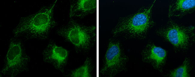 FACL4 antibody [GT186] detects FACL4 protein at mitochondria by immunofluorescent analysis. Sample: HeLa cells were fixed in ice-cold MeOH for 5 min. Green: FACL4 stained by FACL4 antibody [GT186] (GTX633365) diluted at 1:100. Blue: Hoechst 33342 staining.