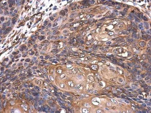 ROCK2 antibody [GT11712]
