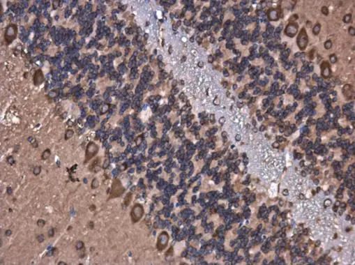 ROCK2 antibody [GT11712]