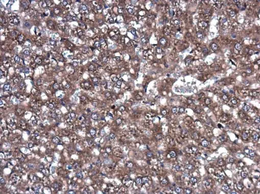 ROCK2 antibody [GT11712]