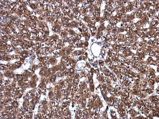 ATP6V1A antibody [GT3846] detects ATP6V1A protein at cytoplasm in rat liver by immunohistochemical analysis. Sample: Paraffin-embedded rat liver. ATP6V1A antibody [GT3846] (GTX633542) diluted at 1:200. 
 Antigen Retrieval: Citrate buffer, pH 6.0, 15 min
