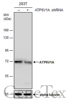 Non-transfected (–) and transfected (+) 293T whole cell extracts (30 μg) were separated by 7.5% SDS-PAGE, and the membrane was blotted with ATP6V1A antibody [GT3846] (GTX633542) diluted at 1:500.
