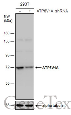 Non-transfected (–) and transfected (+) 293T whole cell extracts (30 μg) were separated by 7.5% SDS-PAGE, and the membrane was blotted with ATP6V1A antibody [GT811] (GTX633543) diluted at 1:500.