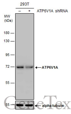 Non-transfected (–) and transfected (+) 293T whole cell extracts (30 μg) were separated by 7.5% SDS-PAGE, and the membrane was blotted with ATP6V1A antibody [GT1561] (GTX633544) diluted at 1:500.