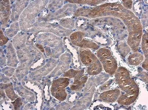 PSAT1 antibody [GT2918] detects PSAT1 protein at cytoplasm in mouse kidney by immunohistochemical analysis. Sample: Paraffin-embedded mouse kidney. PSAT1 antibody [GT2918] (GTX633623) diluted at 1:200. 
 Antigen Retrieval: Citrate buffer, pH 6.0, 15 min
