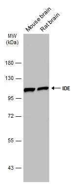 Various tissue extracts (50 μg) were separated by 7.5% SDS-PAGE, and the membrane was blotted with IDE antibody [GT286] (GTX633625) diluted at 1:1000. The HRP-conjugated anti-mouse IgG antibody (GTX213111-01) was used to detect the primary antibody.