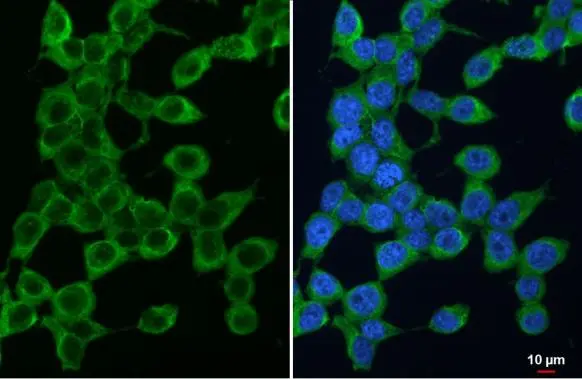 PSAT1 antibody [GT1353] detects PSAT1 protein at cytoplasm by immunofluorescent analysis. Sample: 293T cells were fixed in 4% paraformaldehyde at RT for 15 min. Green: PSAT1 stained by PSAT1 antibody [GT1353] (GTX633629) diluted at 1:500. Blue: Fluoroshield with DAPI (GTX30920).