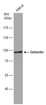 Gelsolin antibody [GT667]