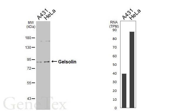 Various whole cell extracts (30 μg) were separated by 7.5% SDS-PAGE, and the membrane was blotted with Gelsolin antibody [GT667] (GTX633675) diluted at 1:1000. The HRP-conjugated anti-mouse IgG antibody (GTX213111-01) was used to detect the primary antibody. Corresponding RNA expression data are based on Human Protein Atlas program.