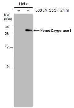Untreated (–) and treated (+) HeLa whole cell extracts (30 μg) were separated by 15% SDS-PAGE, and the membrane was blotted with Heme Oxygenase 1 antibody [GT1334] (GTX633676) diluted at 1:1000.