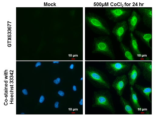 Heme Oxygenase 1 antibody [GT17811] detects Heme Oxygenase 1 protein at endoplasmic reticulum by immunofluorescent analysis. Sample: Mock and treated HeLa cells were fixed in 4% paraformaldehyde at RT for 15 min. Green: Heme Oxygenase 1 stained by Heme Oxygenase 1 antibody [GT17811] (GTX633677) diluted at 1:2000. Blue: Hoechst 33342 staining. Scale bar= 10μm.