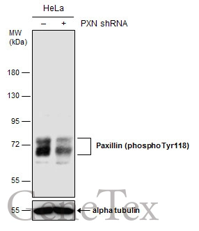 Non-transfected (–) and transfected (+) HeLa whole cell extracts (50 μg) were separated by 7.5% SDS-PAGE, and the membrane was blotted with Paxillin (phospho Tyr118) antibody [GT162] (GTX633678) diluted at 1:500.