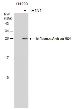 Non-infected (–) and infected (+) H1299 whole cell extracts (15 μg) were separated by 15% SDS-PAGE, and the membrane was blotted with Influenza A virus NS1 antibody [GT1943] (GTX633686) diluted at 1:1000.