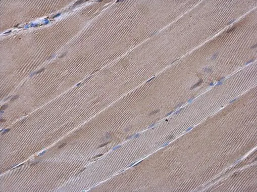 Gelsolin antibody [GT1656] detects Gelsolin protein at cytoplasm in rat muscle by immunohistochemical analysis. Sample: Paraffin-embedded rat muscle. Gelsolin antibody [GT1656] (GTX633690) diluted at 1:200. 
 Antigen Retrieval: Citrate buffer, pH 6.0, 15 min