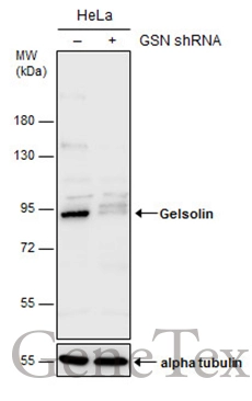 Non-transfected (–) and transfected (+) HeLa whole cell extracts (30 μg) were separated by 7.5% SDS-PAGE, and the membrane was blotted with Gelsolin antibody [GT1656] (GTX633690) diluted at 1:500.