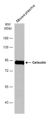 Mouse tissue extract (50 μg) was separated by 7.5% SDS-PAGE, and the membrane was blotted with Gelsolin antibody [GT1656] (GTX633690) diluted at 1:1000. The HRP-conjugated anti-mouse IgG antibody (GTX213111-01) was used to detect the primary antibody.
