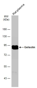 Rat tissue extract (50 μg) was separated by 7.5% SDS-PAGE, and the membrane was blotted with Gelsolin antibody [GT1656] (GTX633690) diluted at 1:1000. The HRP-conjugated anti-mouse IgG antibody (GTX213111-01) was used to detect the primary antibody.