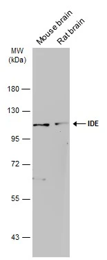 Various tissue extracts (50 μg) were separated by 7.5% SDS-PAGE, and the membrane was blotted with IDE antibody [GT143] (GTX633694) diluted at 1:1000. The HRP-conjugated anti-mouse IgG antibody (GTX213111-01) was used to detect the primary antibody.