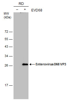 GTX633706 WB Image