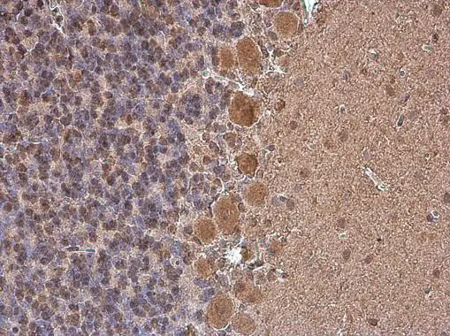 p130Cas antibody [GT331] detects p130Cas protein at cytoplasm in rat brain by immunohistochemical analysis. Sample: Paraffin-embedded rat brain. p130Cas antibody [GT331] (GTX633771) diluted at 1:200. 
 Antigen Retrieval: Citrate buffer, pH 6.0, 15 min