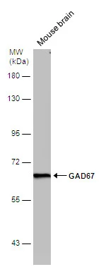 GAD67 antibody [GT1982]