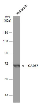 GAD67 antibody [GT1982]