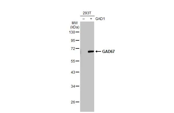 GAD67 antibody [GT1982]