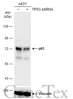 Non-transfected (–) and transfected (+) A431 whole cell extracts (30 μg) were separated by 7.5% SDS-PAGE, and the membrane was blotted with p63 antibody [GT1179] (GTX633818) diluted at 1:2000. The HRP-conjugated anti-mouse IgG antibody (GTX213111-01) was used to detect the primary antibody.