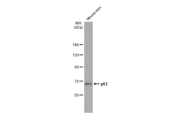 Mouse tissue extract (50 μg) was separated by 7.5% SDS-PAGE, and the membrane was blotted with p63 antibody [GT1179] (GTX633818) diluted at 1:2000. The HRP-conjugated anti-mouse IgG antibody (GTX213111-01) was used to detect the primary antibody.