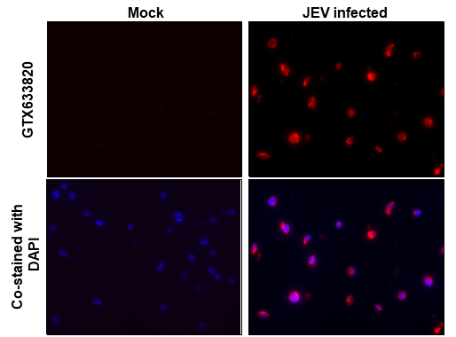NS1 (JEV) antibody [GT1410] detects NS1 (JEV) protein at cytoplasm by immunohistochemical analysis. Sample: Paraffin-embedded japanese encephalitis virus BHK-21. Red: NS1 (JEV) stained by NS1 (JEV) antibody [GT1410] (GTX633820) diluted at 1:500. Blue: Fluoroshield with DAPI (GTX30920). Antigen Retrieval: Citrate buffer, pH 6.0, 15 min