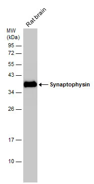 Rat tissue extract (50 μg) was separated by 12% SDS-PAGE, and the membrane was blotted with Synaptophysin antibody (GTX633821) diluted at 1:3000. Rat tissue extract (50 μg) was separated by 12% SDS-PAGE, and the membrane was blotted with Synaptophysin antibody (GTX633821) diluted at 1:3000.
