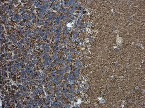 Synaptophysin antibody [GT1825] detects Synaptophysin protein at cell membrane in rat brain by immunohistochemical analysis. Sample: Paraffin-embedded rat brain. Synaptophysin antibody [GT1825] (GTX633821) diluted at 1:200. 
 Antigen Retrieval: Citrate buffer, pH 6.0, 15 min