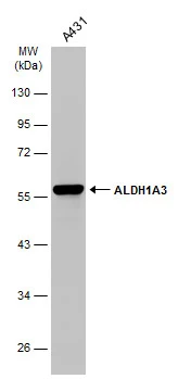 Whole cell extract (30 μg) was separated by 10% SDS-PAGE, and the membrane was blotted with ALDH1A3 antibody [GT926] (GTX633822) diluted at 1:1000. The HRP-conjugated anti-mouse IgG antibody (GTX213111-01) was used to detect the primary antibody.