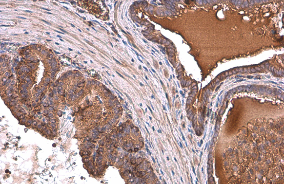 ALDH1A3 antibody [GT926] detects ALDH1A3 protein at cytoplasm by immunohistochemical analysis. Sample: Paraffin-embedded mouse prostate. ALDH1A3 stained by ALDH1A3 antibody [GT926] (GTX633822) diluted at 1:200. Antigen Retrieval: Citrate buffer, pH 6.0, 15 min