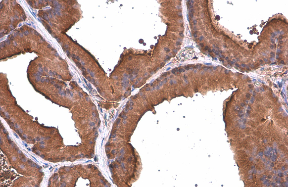 ALDH1A3 antibody [GT926] detects ALDH1A3 protein at cytoplasm by immunohistochemical analysis. Sample: Paraffin-embedded rat prostate. ALDH1A3 stained by ALDH1A3 antibody [GT926] (GTX633822) diluted at 1:200. Antigen Retrieval: Citrate buffer, pH 6.0, 15 min