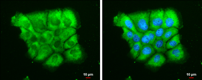 Dicer antibody [GT1176] detects Dicer protein at cytoplasm by immunofluorescent analysis. Sample: A431 cells were fixed in 4% paraformaldehyde at RT for 15 min. Green: Dicer stained by Dicer antibody [GT1176] (GTX633917) diluted at 1:500. Blue: Hoechst 33342 staining. Scale bar= 10μm.