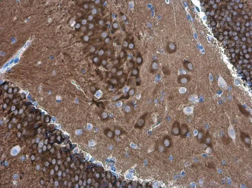 PYK2 antibody [GT1132]