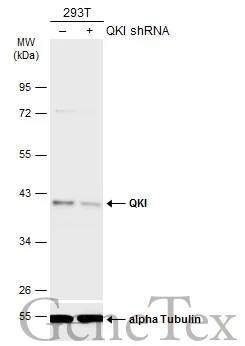 Non-transfected (–) and transfected (+) 293T whole cell extracts (30 μg) were separated by 10% SDS-PAGE, and the membrane was blotted with QKI antibody [GT1589] (GTX633920) diluted at 1:5000. The HRP-conjugated anti-mouset IgG antibody (GTX213111-01) was used to detect the primary antibody.