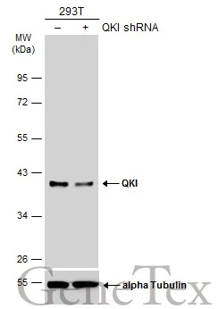 QKI antibody [GT2612]