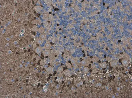QKI antibody [GT228]