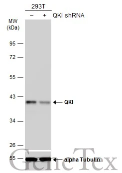 QKI antibody [GT228]