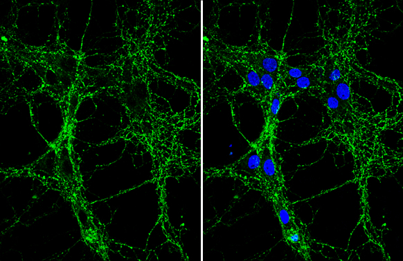 A protein encoded by circular ZNF609 RNA induces acute