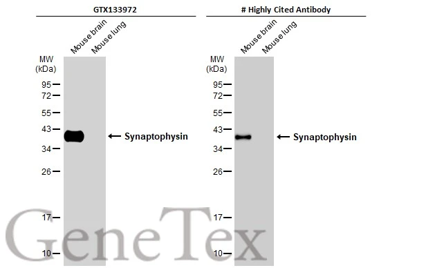 Anti-Synaptophysin antibody [GT2589] (GTX633972) | GeneTex